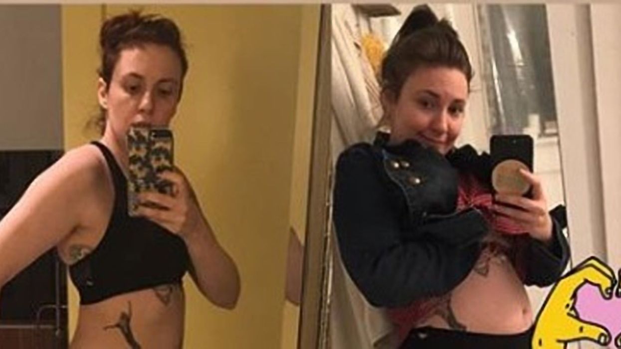 Lena Dunham shares before and after pics to prove being thin isn't everything