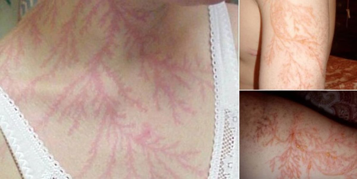 Incredible Photos Show What Can Happen To Your Body If You re Struck By incredible-photos-show-what-can-happen-to-your-body-if-you-re-struck-by