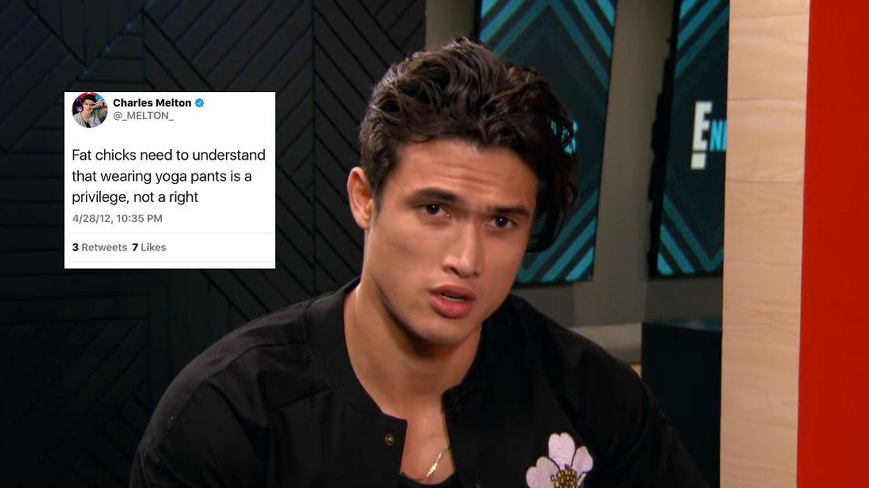 Riverdale actor criticised for 'fat shaming'