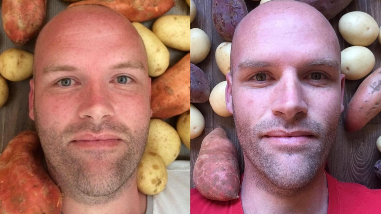 This is what happens to your body if you only eat potatoes for a year