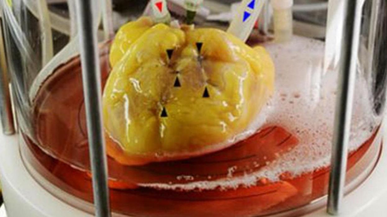 These scientists used spinach leaves to grow beating human heart tissue