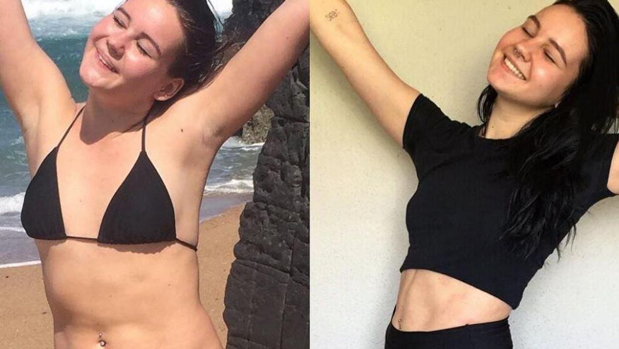 An expert explains what these two photos really tell you about calorie intake