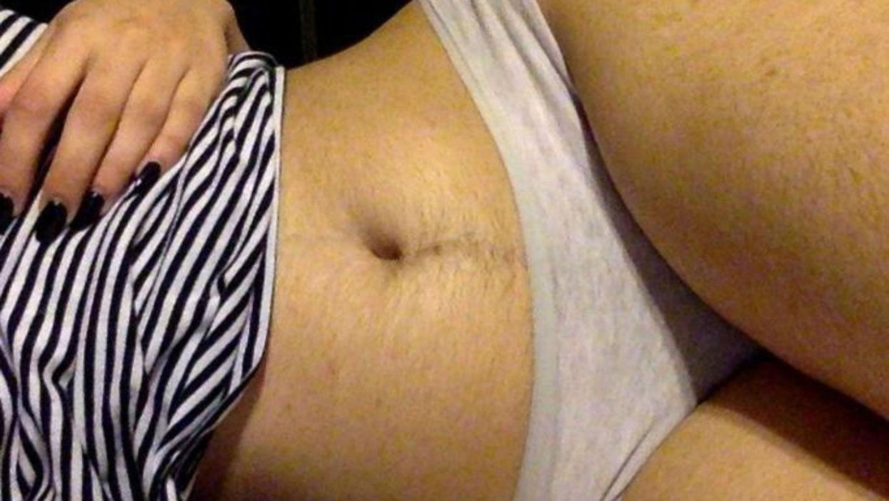 Woman trolled for body hair selfie is brilliantly shutting down body shamers everywhere