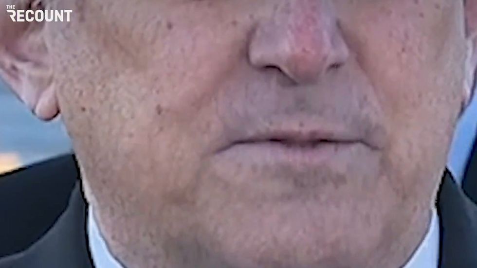 Representative Louie Gohmert appears to lose a tooth on live TV