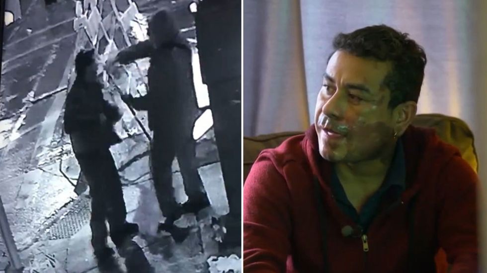 Man attacked with battery acid in apparent hate crime