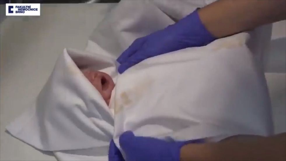 Doctors in the Czech Republic deliver baby 117 days after mother's brain-death