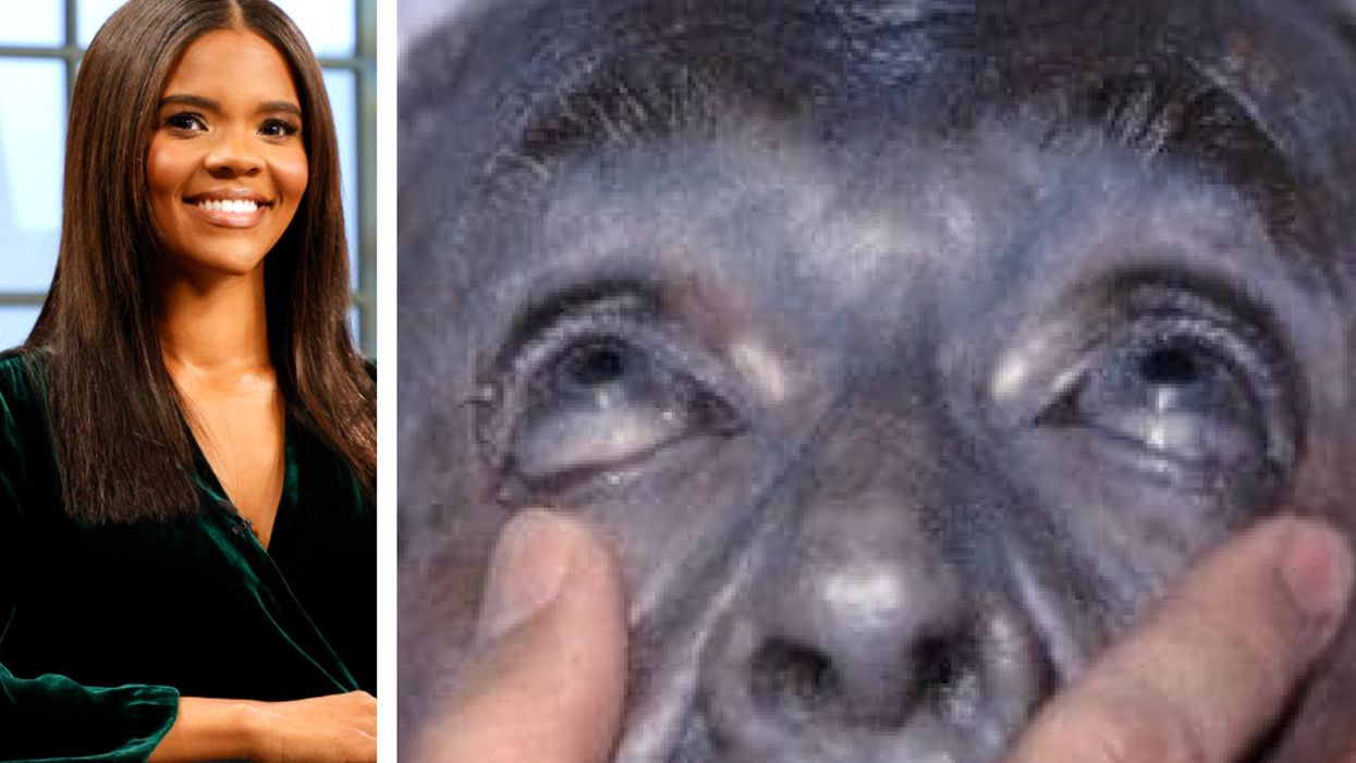 Candace Owens pushes ‘health supplement’ that can turn people’s skin permanently blue