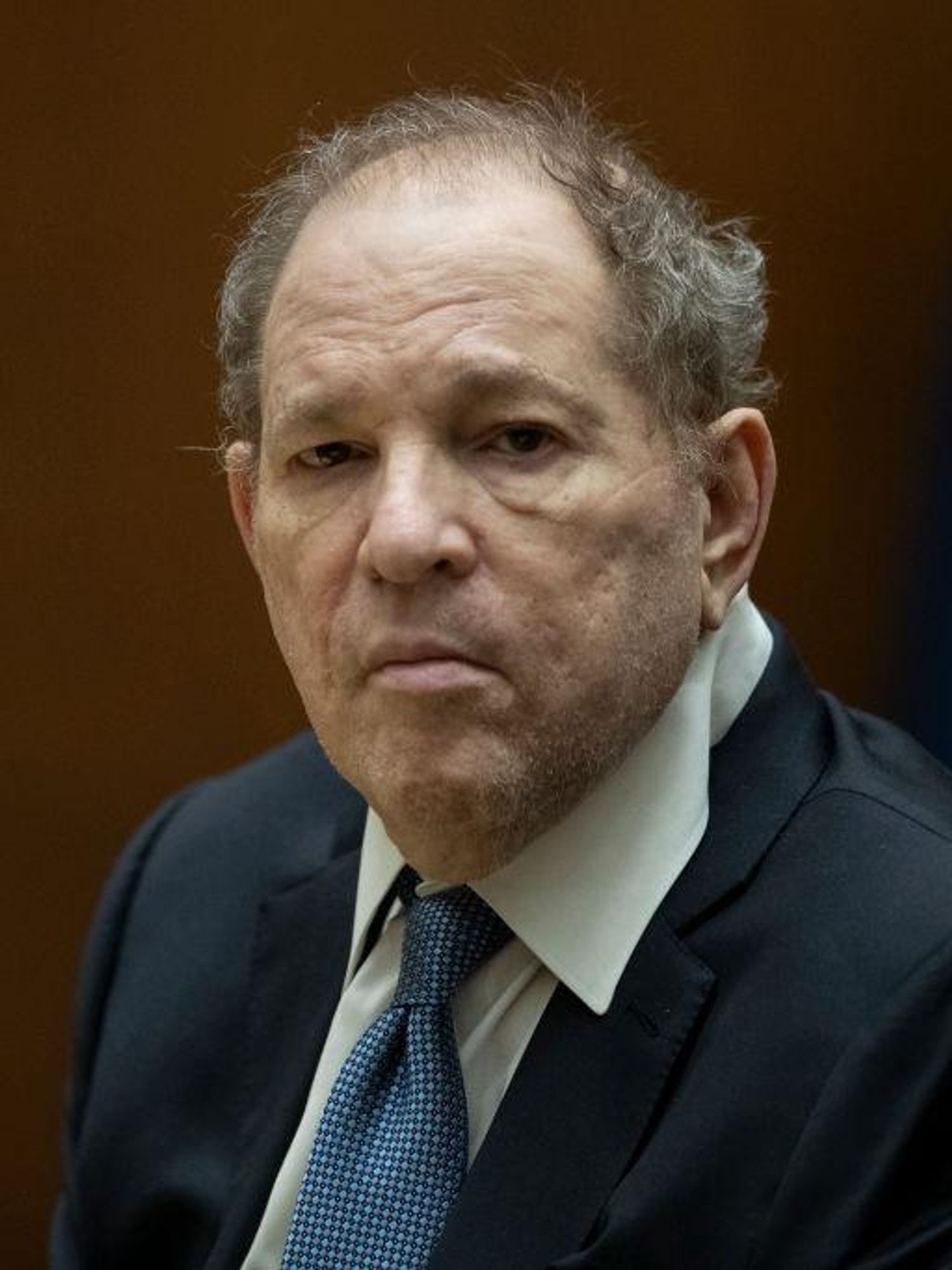 Harvey Weinstein accuser says his penis looked like it had been 'chopped off and sewn back on'