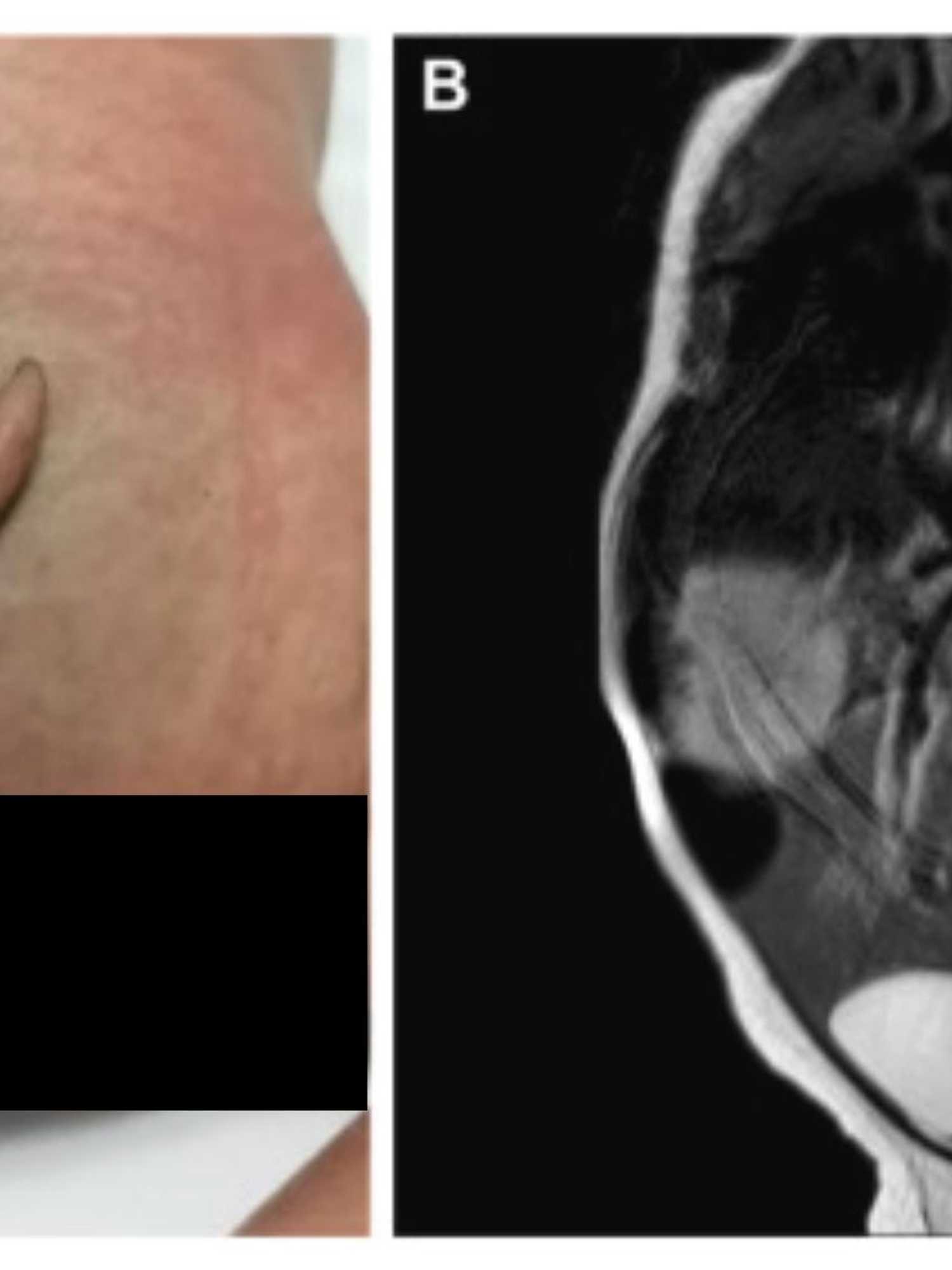 A baby girl was born healthy - but with a 'rare' tail