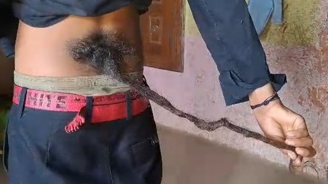 Boy with two-foot long tail growing from his back worshipped as a God