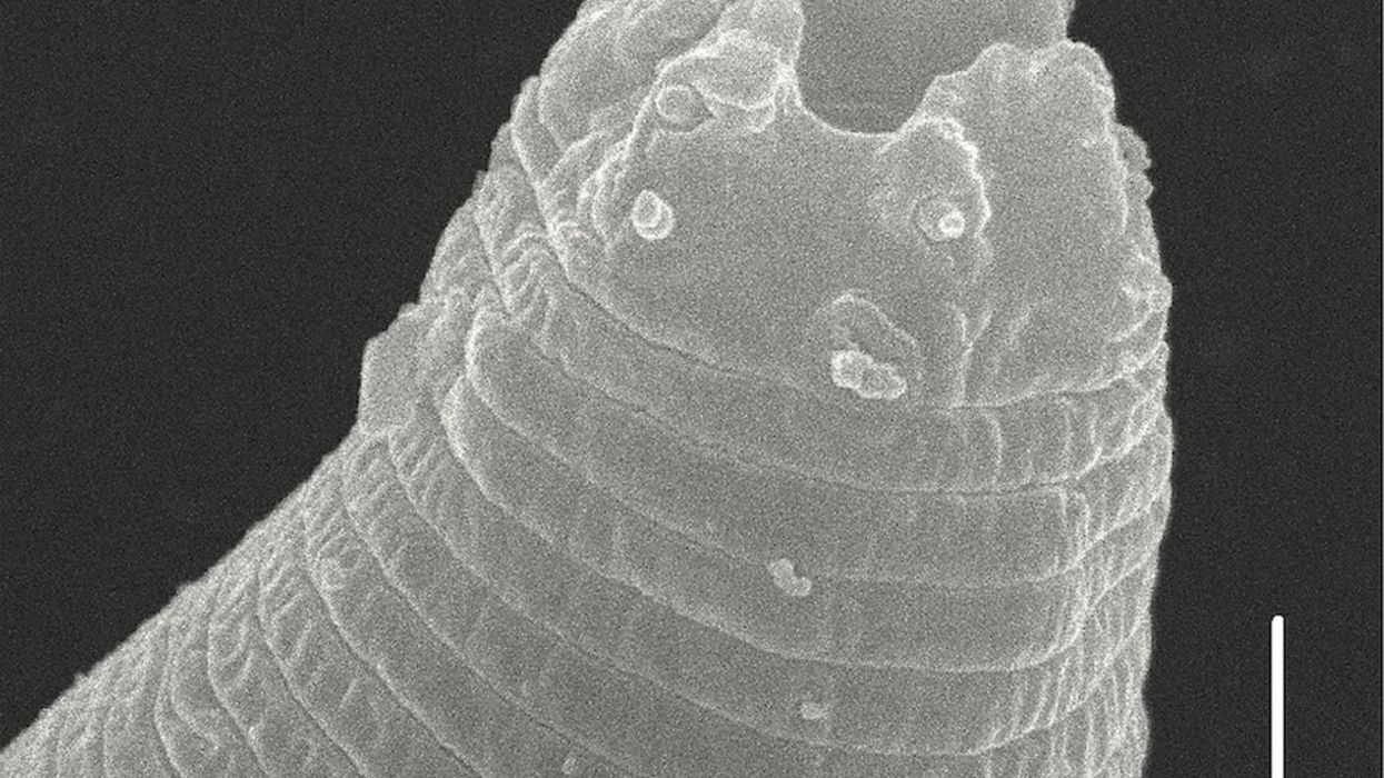 Experts resurrect parasite after 46,000 years in Siberian permafrost