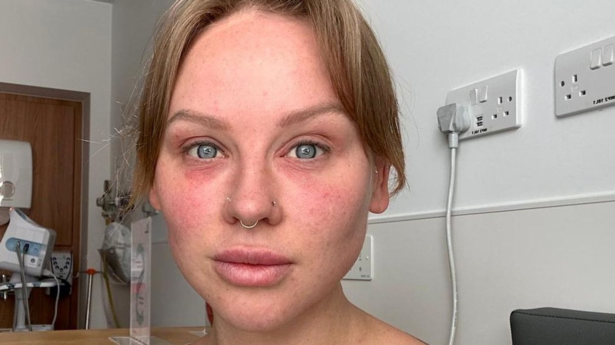 Woman goes blind after having breast implant surgery