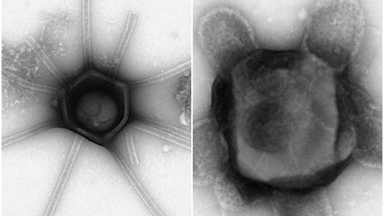 Giant alien-like virus structures with arms and tails found in the US