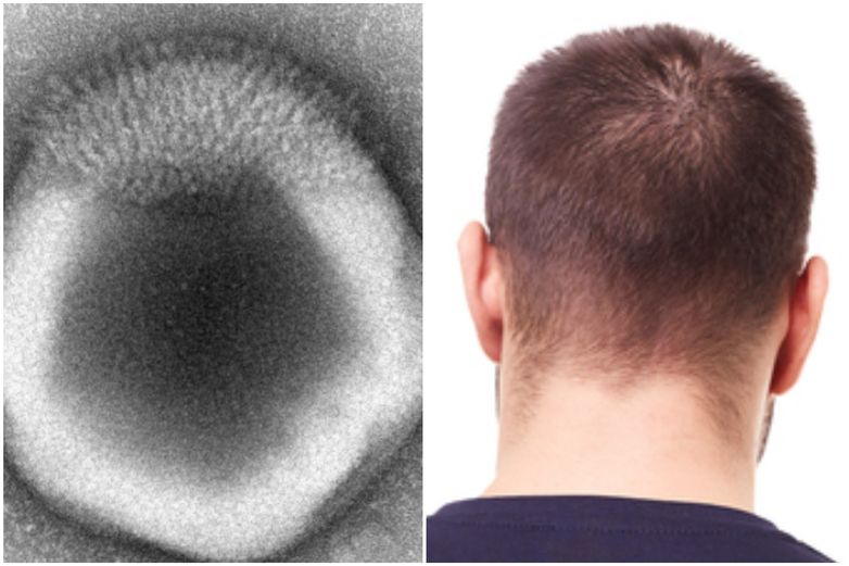 %name Enormes virus parecidos a extraterrestres descubiertos en el suelo del bosque de Harvard