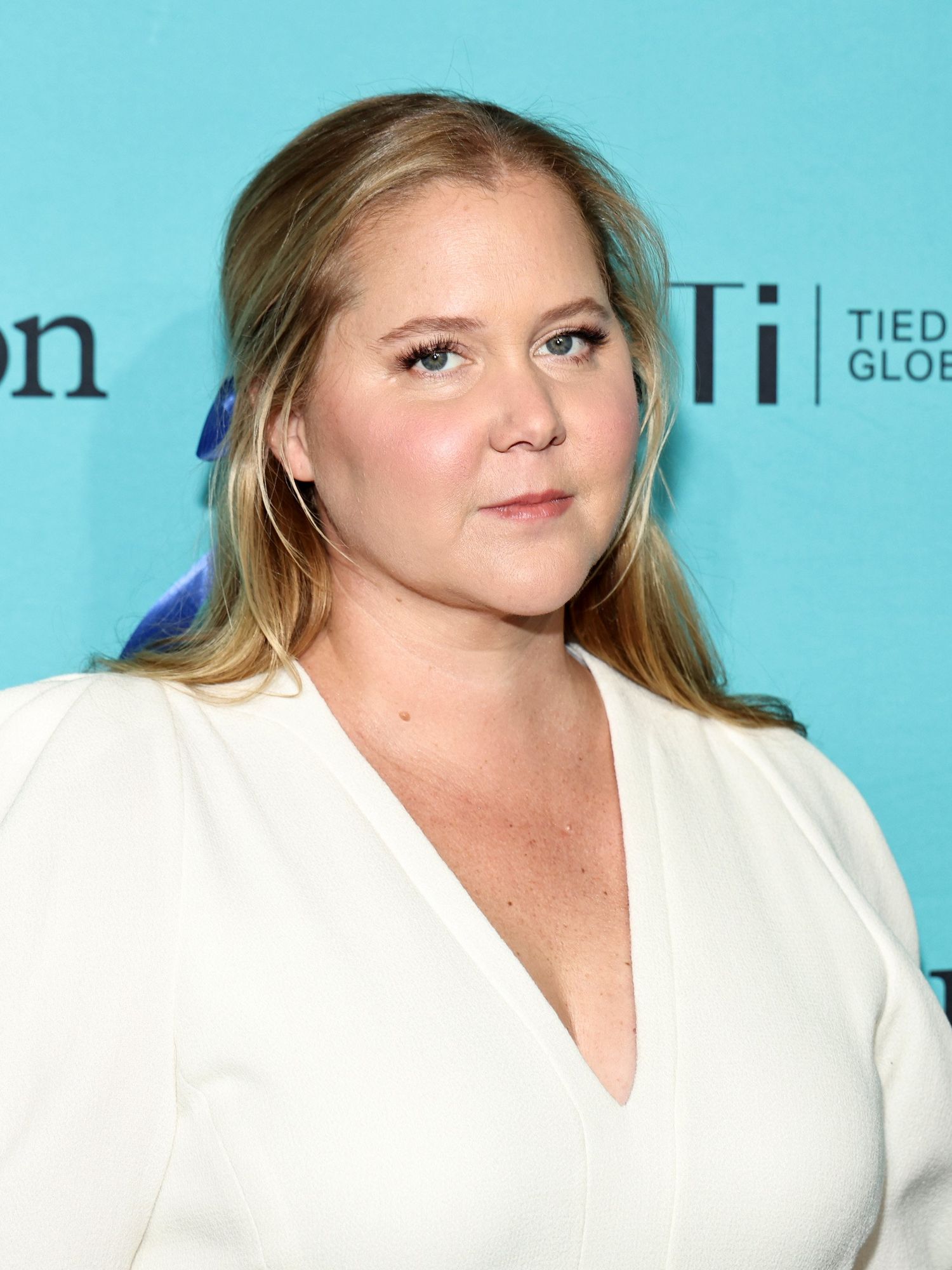 What is Cushing Syndrome? The rare disease suffered by Amy Schumer