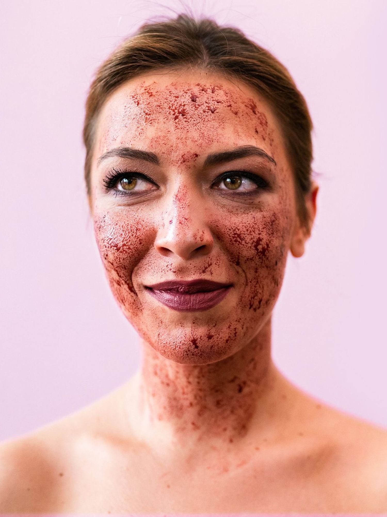 Vampire facial leaves women with HIV