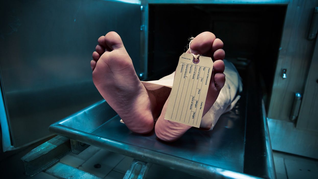 A surprising thing happens to your penis when you die, autopsy expert explains
