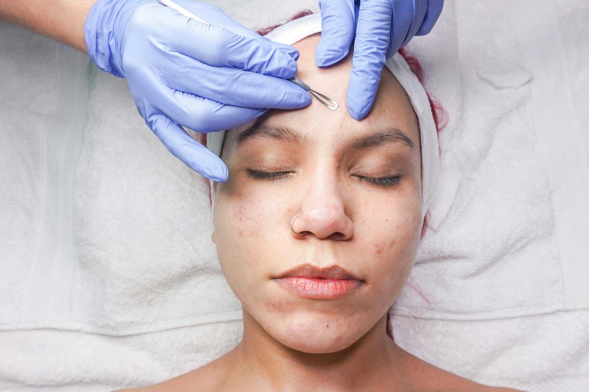 Why you should never pop a pimple in the 'triangle of death' on your face