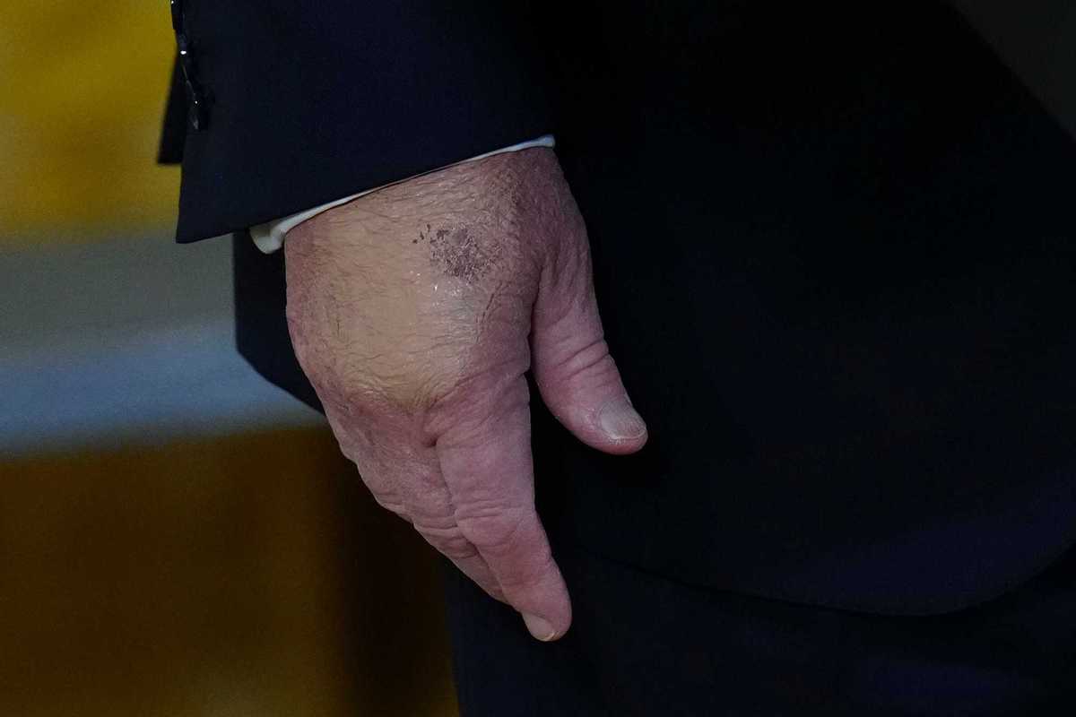 Trump's health in the spotlight again as he undergoes another health check