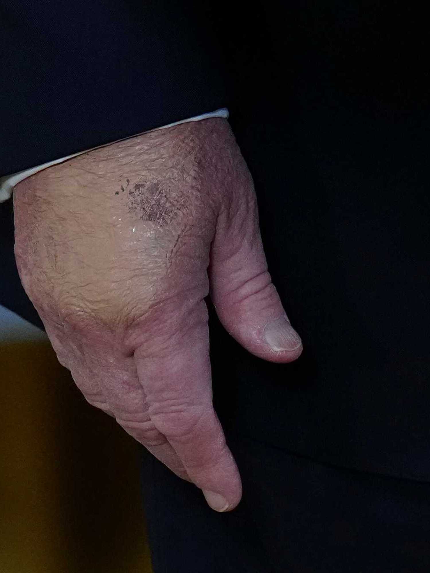 Trump's health in the spotlight again as he undergoes another health check