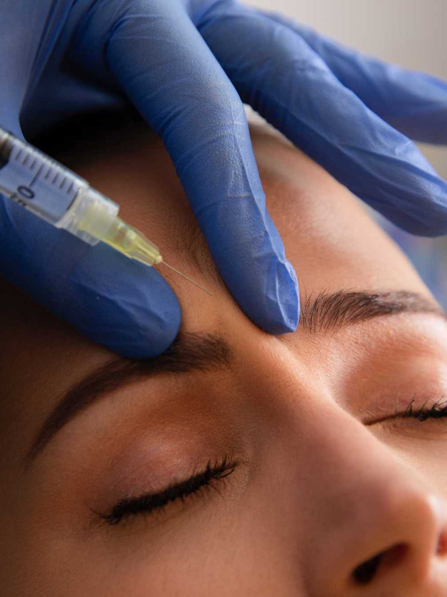 Scientists say Botox could be quietly helping with depression