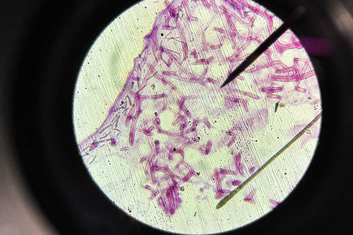 What are spicules? This is why the K-beauty buzzword keeps popping up in your skincare