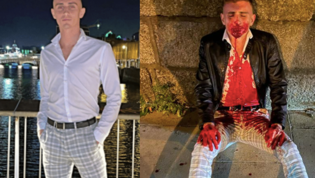 Irish Olympian attacked on Dublin street by gang of 12, leaving him needing surgery