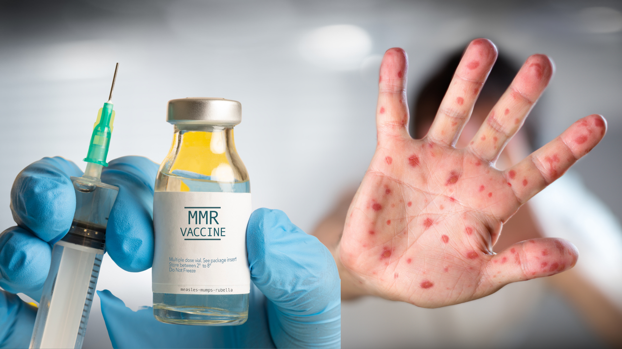Anti-vaxxer's 'disturbing' post about dressing up as measles for Halloween resurfaces