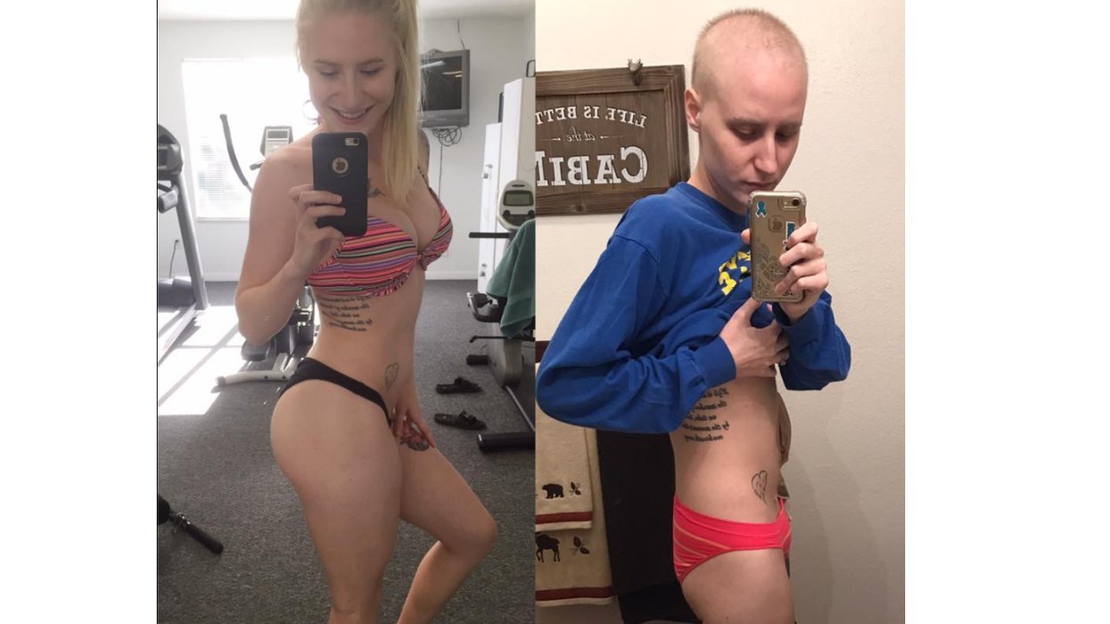 A 23-year-old bodybuilder is being ravaged by ovarian cancer — and Instagramming it all