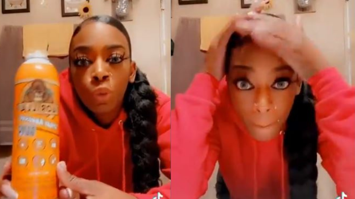 More than $20,000 raised for woman who had her hair removed after mistaking glue for hairspray