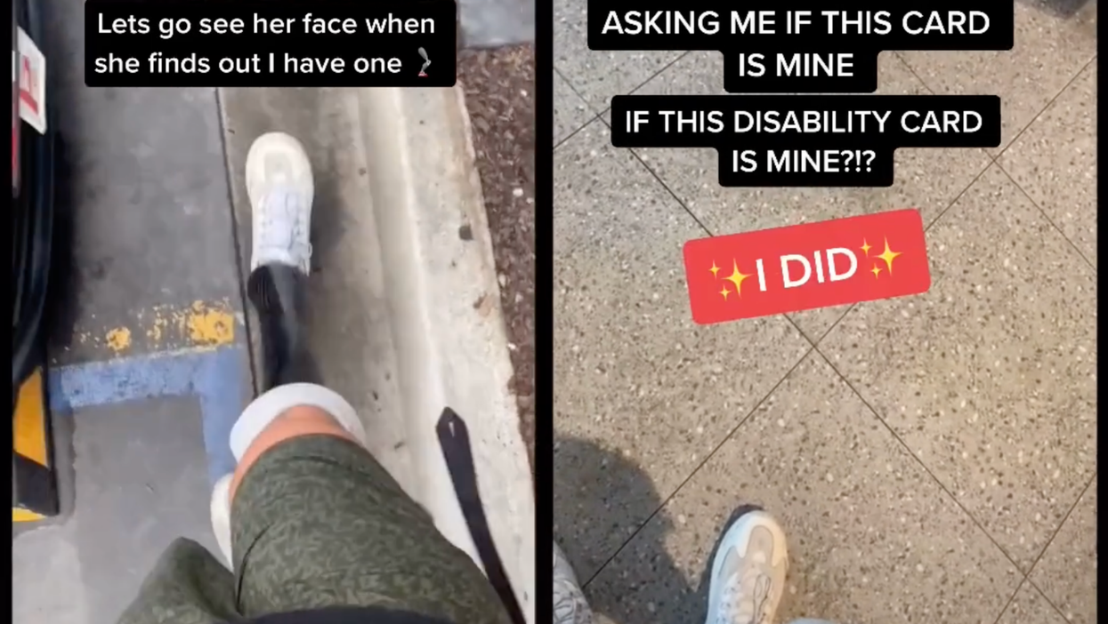 Man forced to show woman his prosthetic leg after she accused him of not being disabled