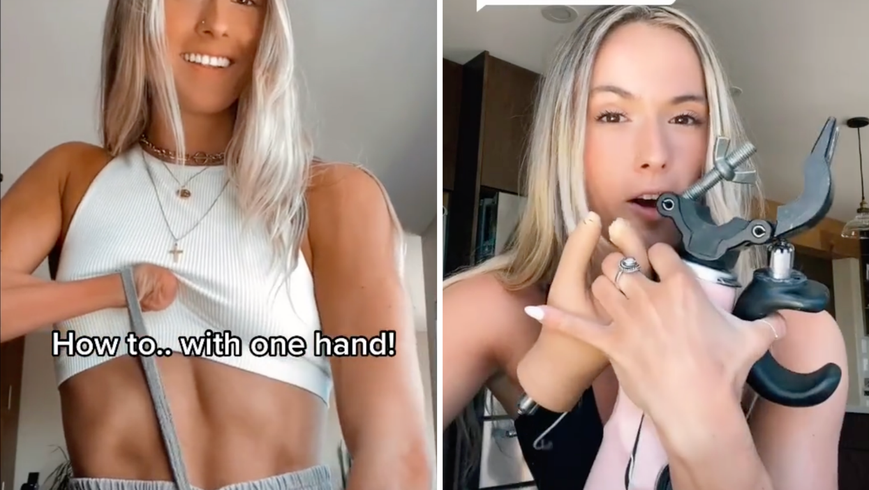Dancer who had hand ripped off in boating accident becomes TikTok star with candid Q+As about her disability
