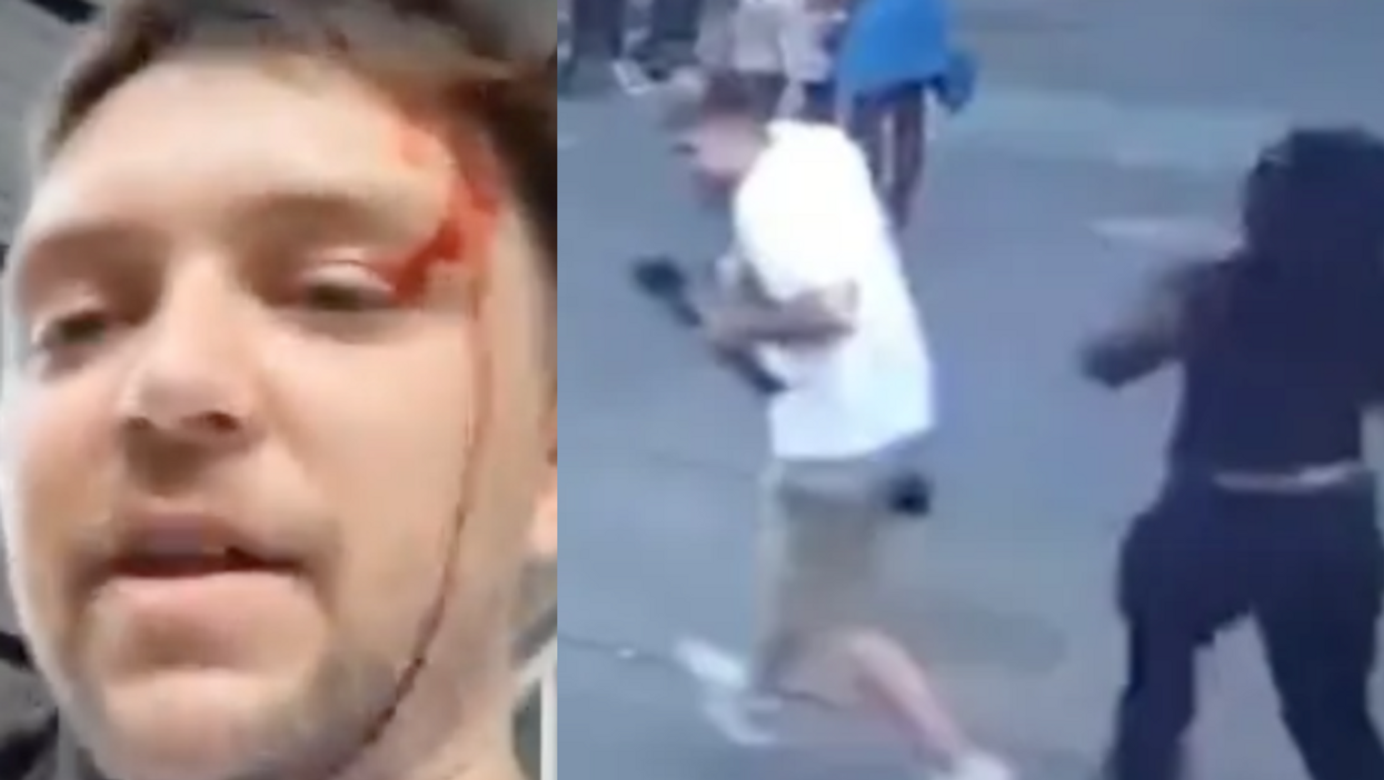 Streamer hit in the head by Black woman after using n-word in front of her