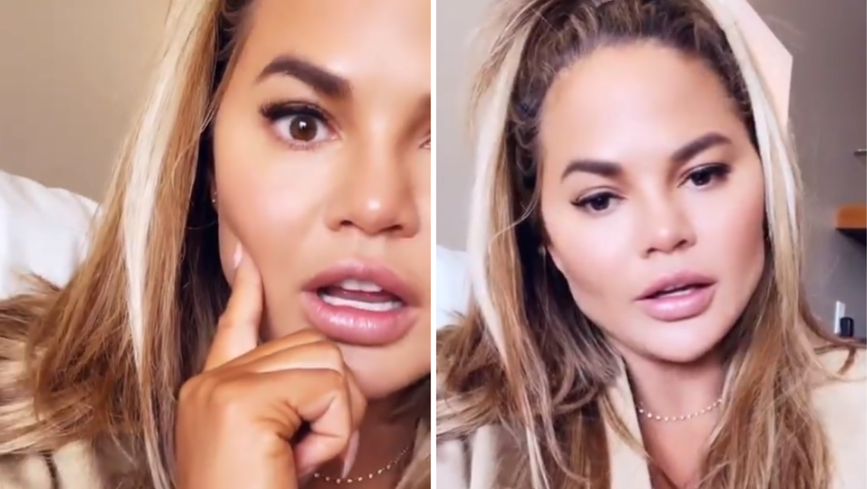 Chrissy Teigen tells how she had cheek reduction surgery – so what is it?