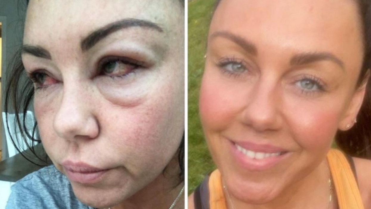 Michelle Heaton shares ‘before and after’ pictures to celebrate 20 weeks of sobriety