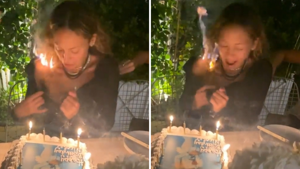 Nicole Richie’s hair caught fire while she was blowing out her birthday candles