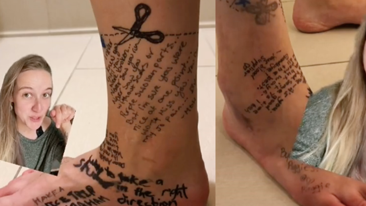 Woman writes break up letter to her foot before having it amputated