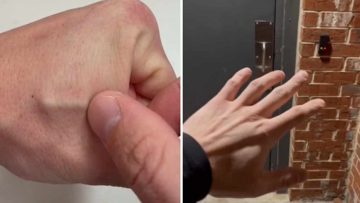 TikTok ‘biohacker’ shows how chip implant makes life more convenient