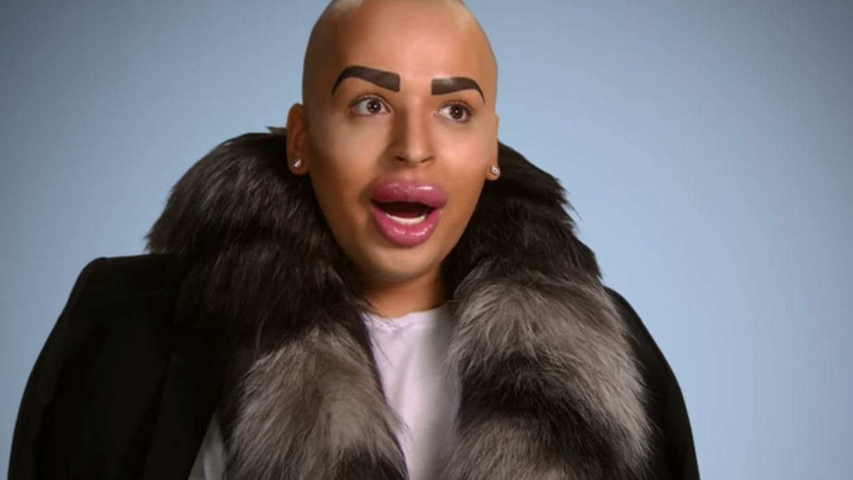Kim Kardashian superfan left with 'leaking' lips after spending £100k on look-a-like surgery