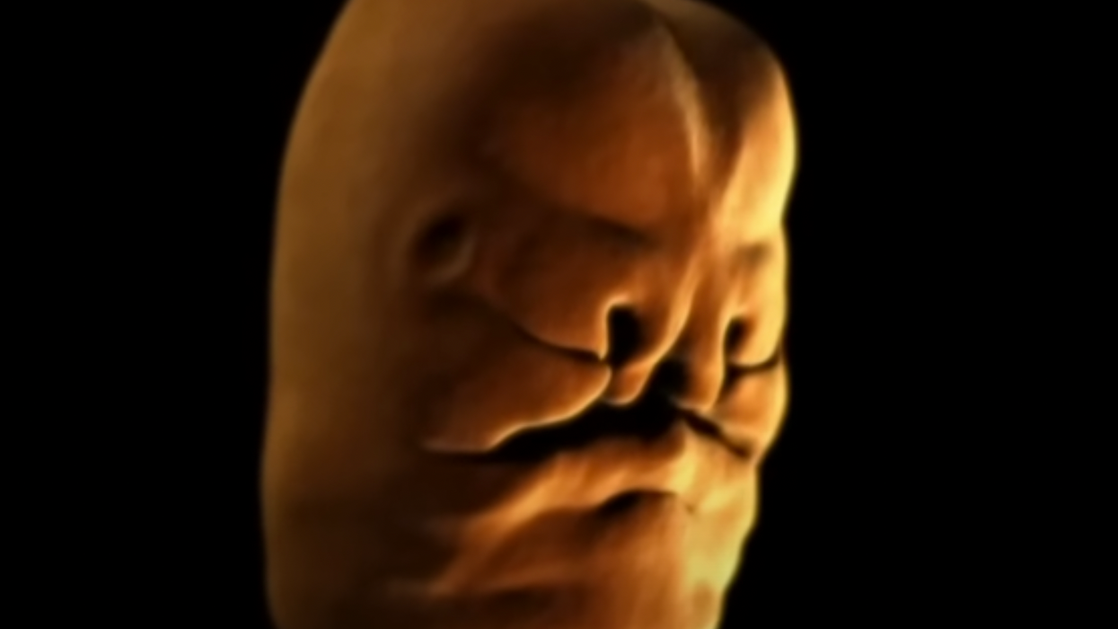 Video showing how babies' faces form is giving people nightmares