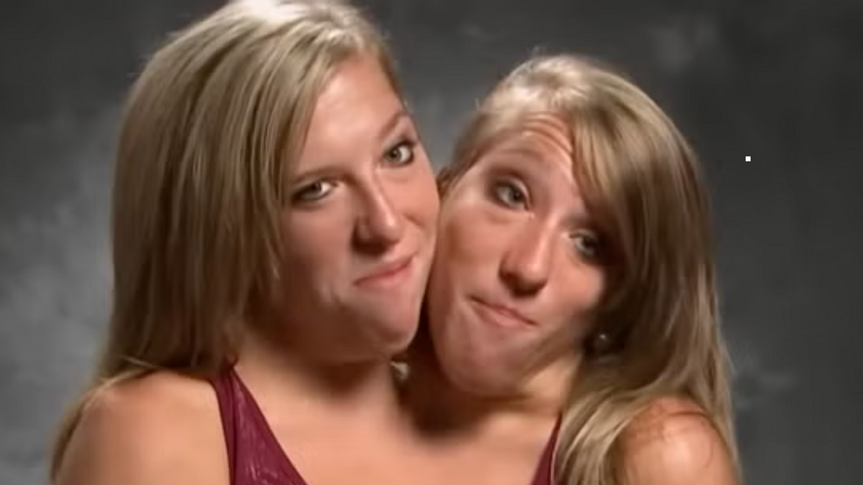 Conjoined twin Abby Hensel is married to army veteran
