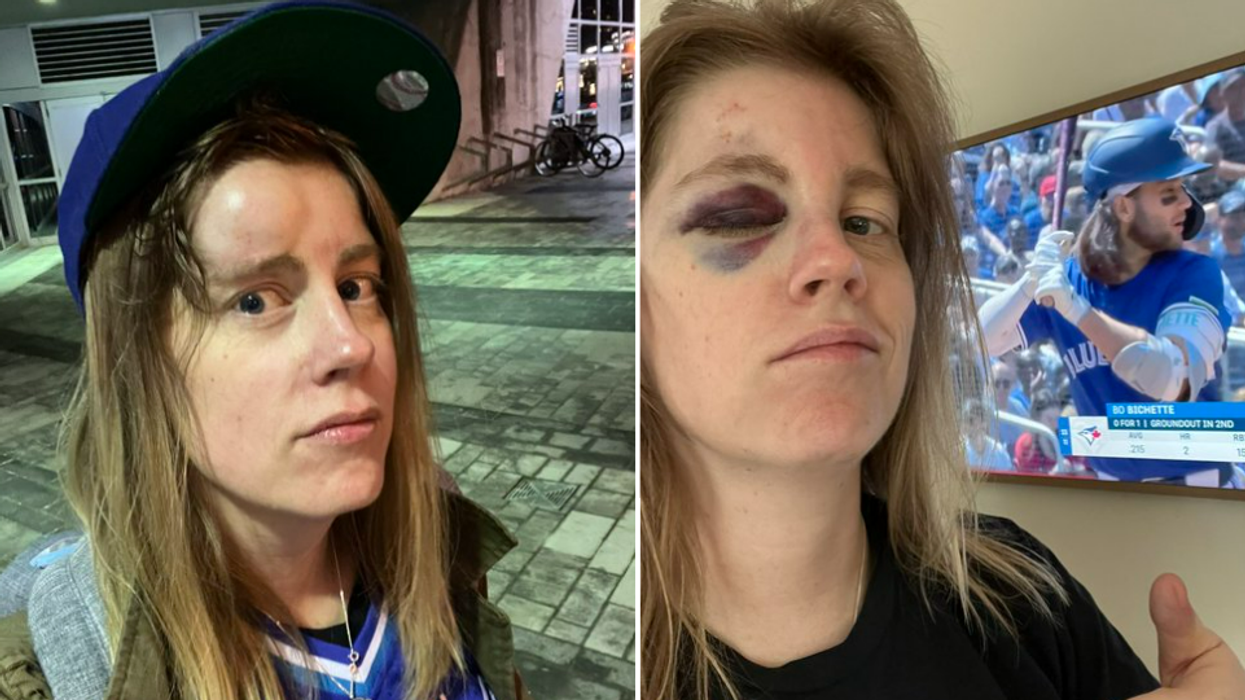 Toronto Blue Jays fan shares brutal reality of getting hit in the face with 110mph baseball