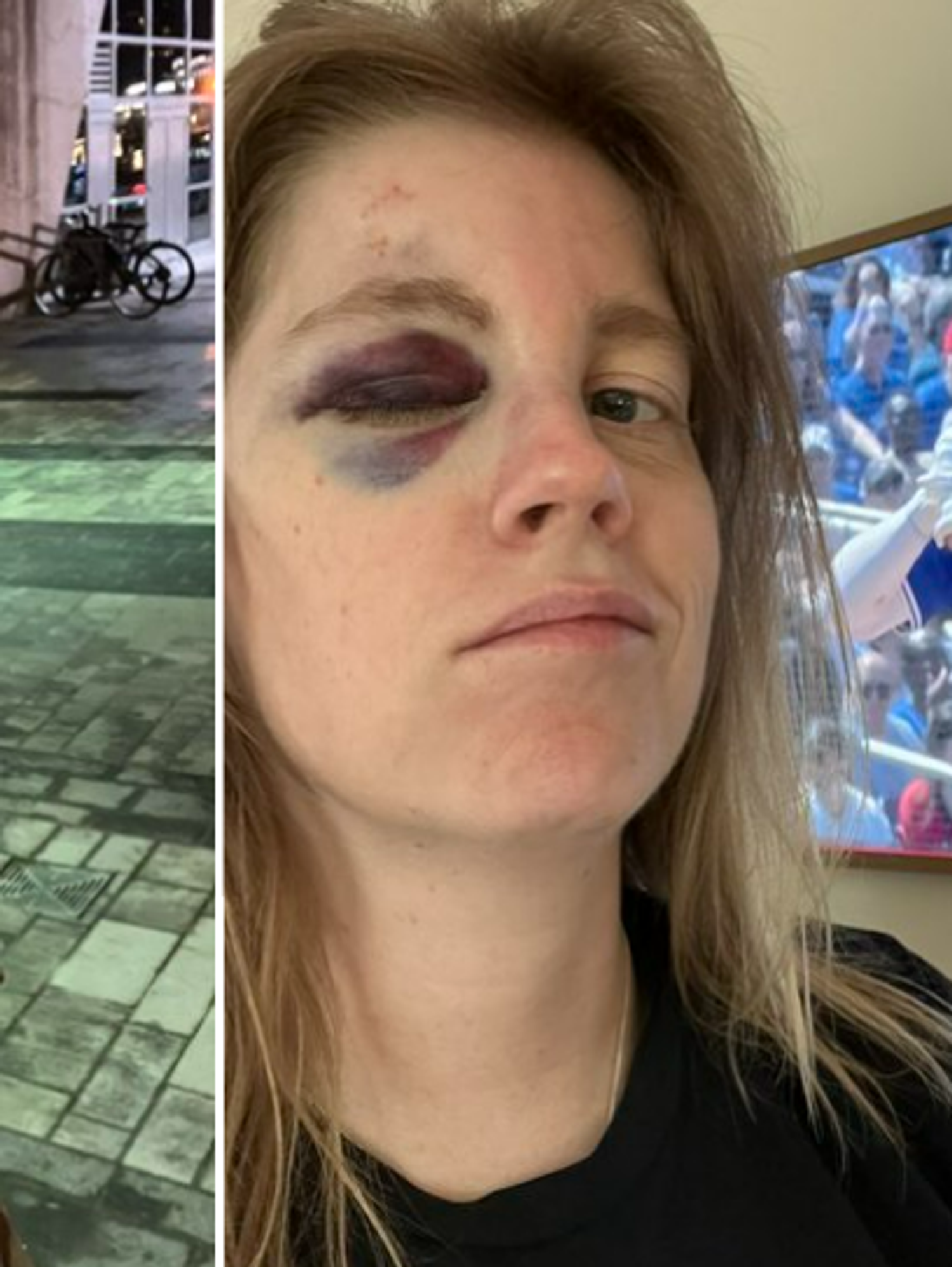 Toronto Blue Jays fan shares brutal reality of getting hit in the face with 110mph baseball