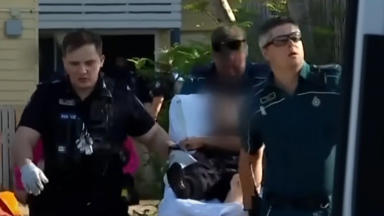 Woman whose dog ripped off her arm says she doesn't blame him