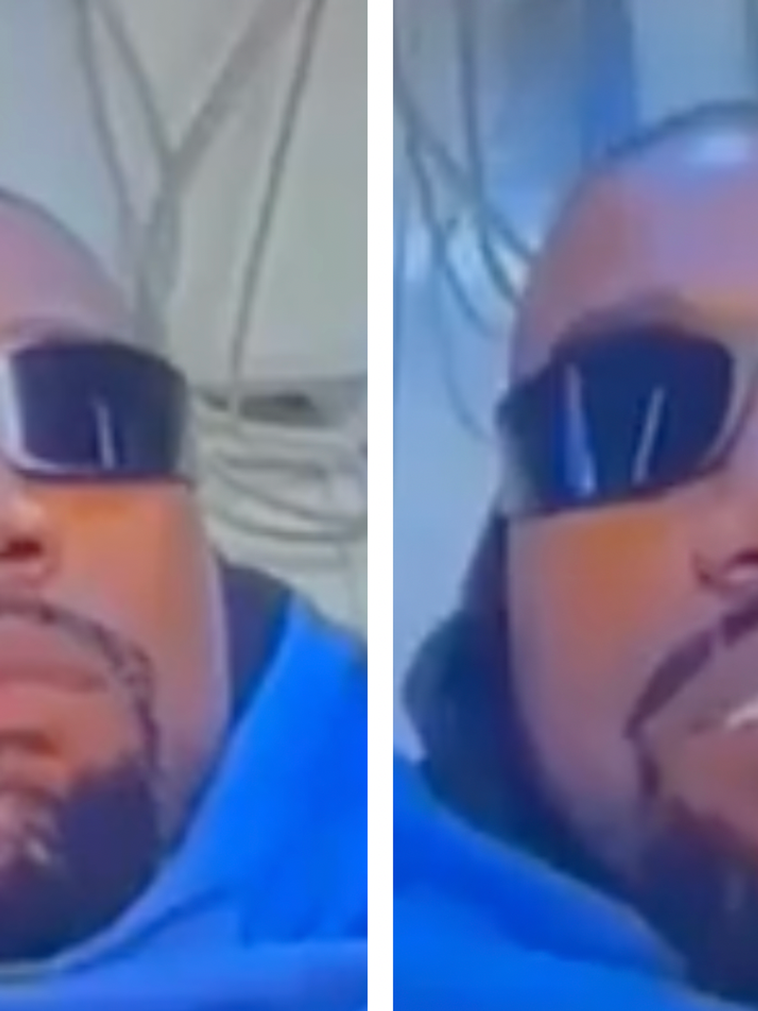 Kanye West drops bizarre Yeezy Super Bowl ad after splurging on teeth