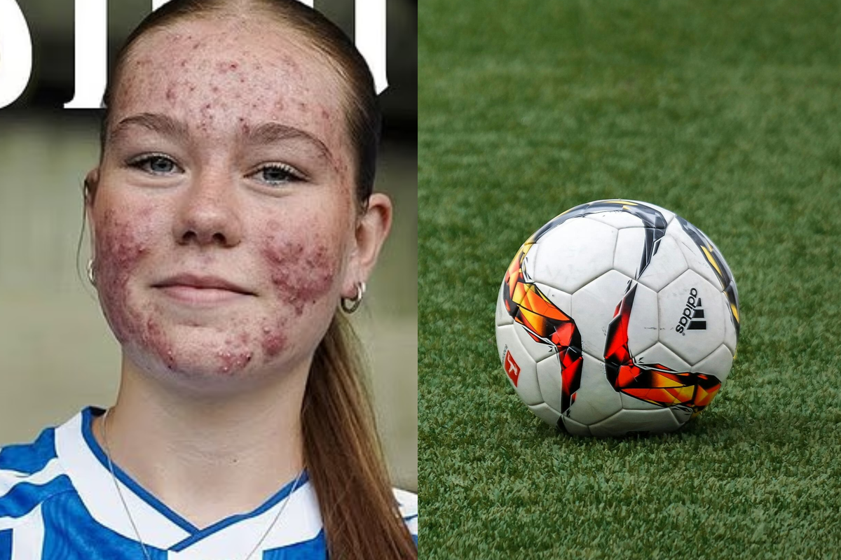 Women's football player bullied online for acne silences trolls perfectly with one move
