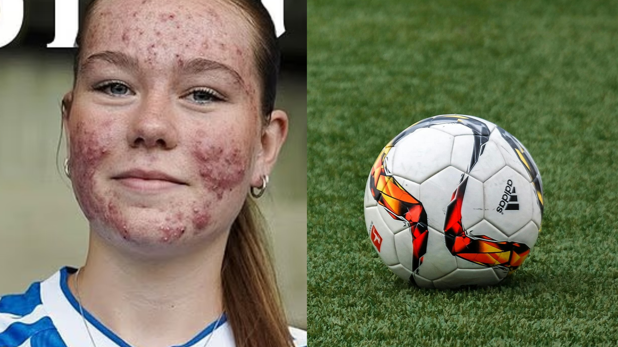 Women's football player bullied online for acne silences trolls perfectly with one move