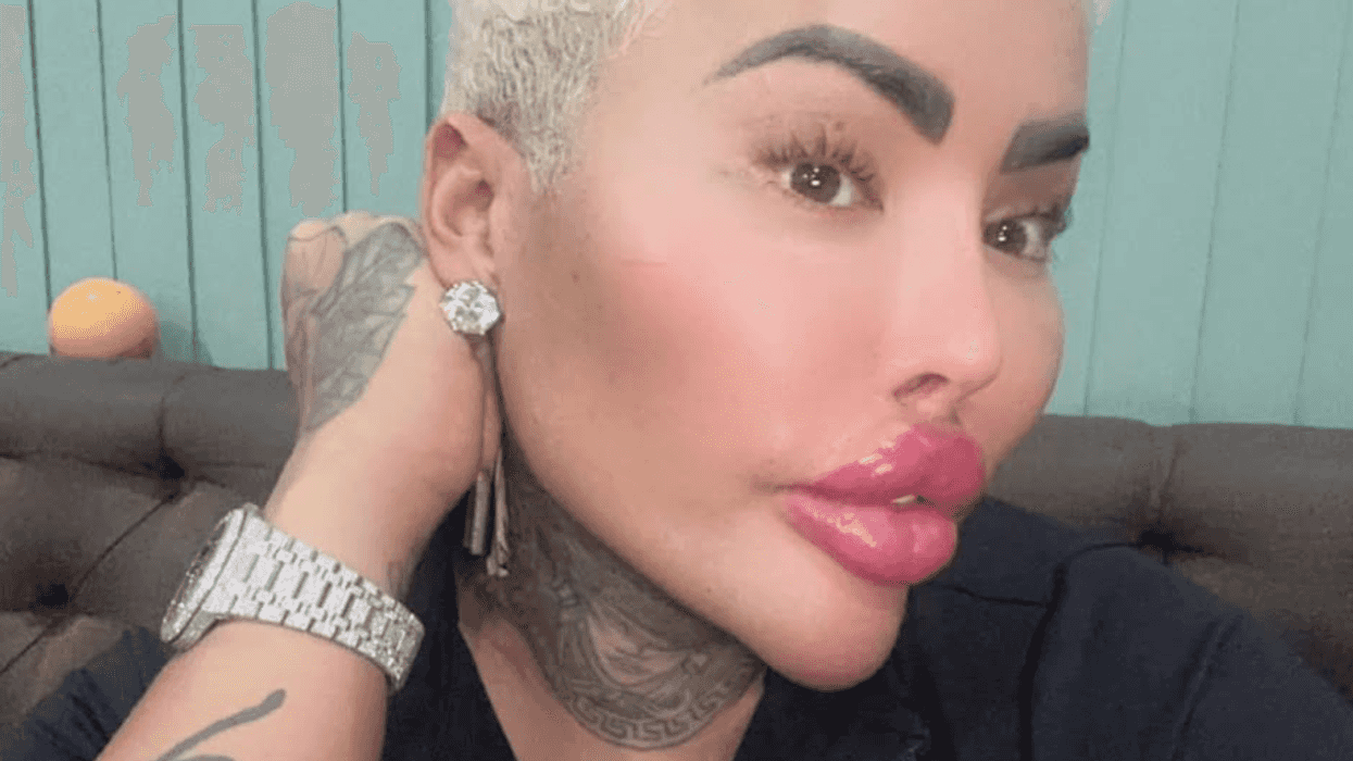 Who is Jordan James Parke? Family heartbroken as ‘Lip King’ influencer dies