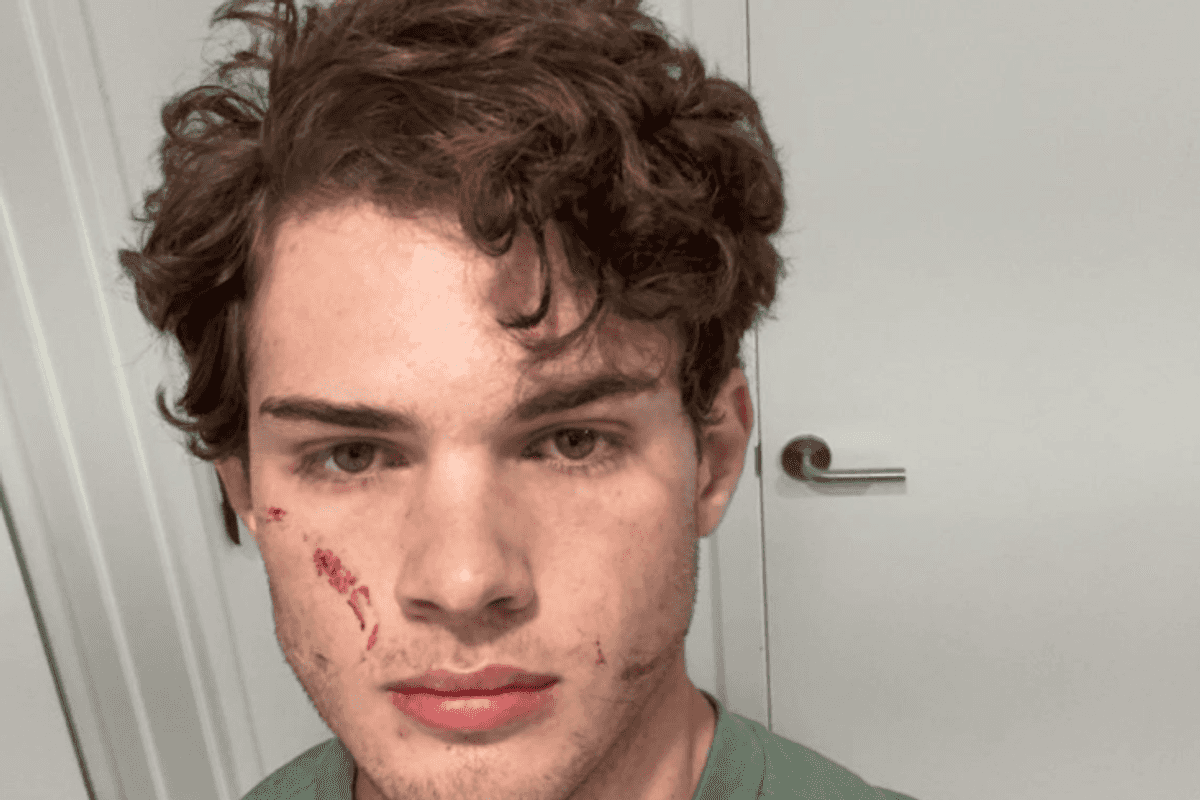 'Looksmaxxing' influencer Clavicular breaks silence after recent hospitalisation