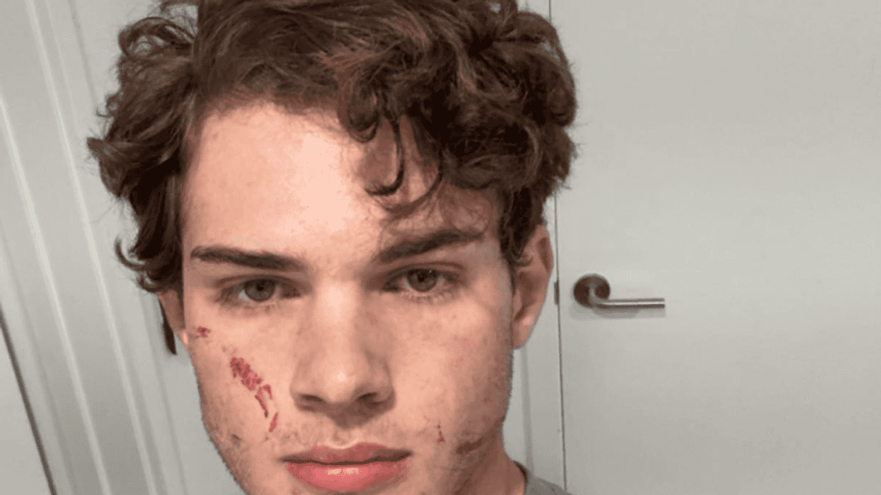 'Looksmaxxing' influencer Clavicular breaks silence after recent hospitalisation